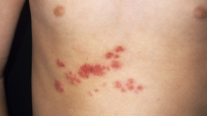 hruq tat-santantnin0